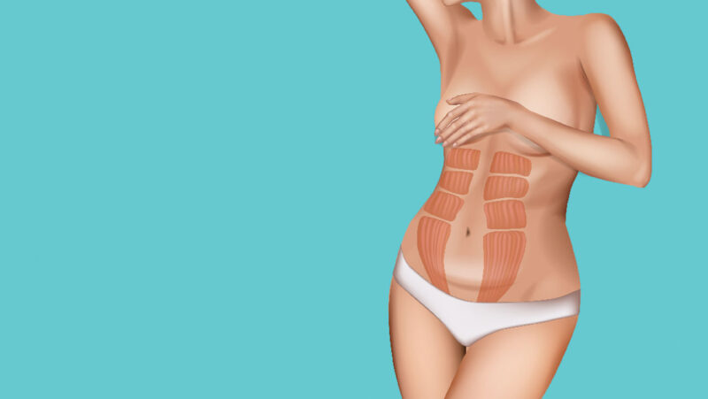 Understanding abdominal separation