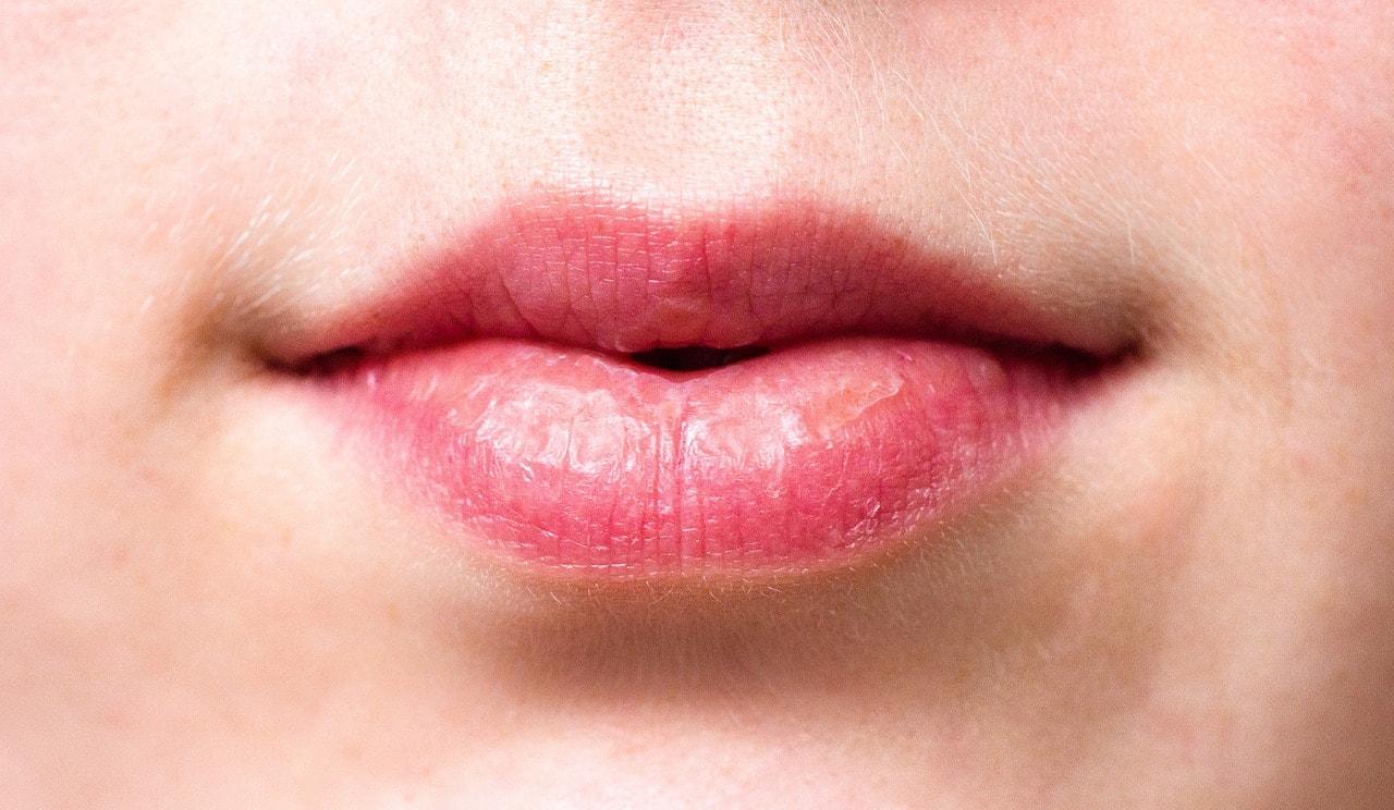 5 signs a Christmas Cold Sore is Coming mouth-2160205_1280
