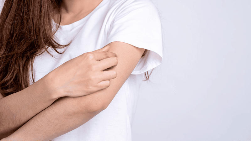 How to Cope with Winter Eczema