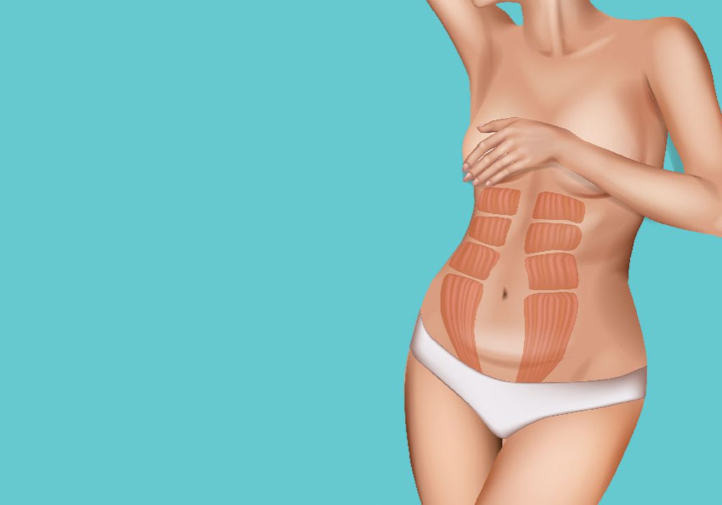 Understanding abdominal separation